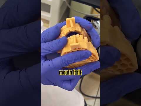 Making Denture Using Digital Impression | Trios Scanner| Digital Dentistry| The Future of Dentistry