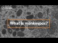 What is monkeypox and how dangerous is it?