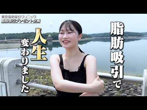 女子大学生の脂肪吸引・脂肪豊胸。１ヶ月でどれだけ変化した！？【脂肪吸引プレゼント企画】