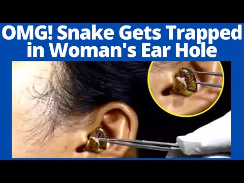 OMG! snake gets stuck in woman's ear, real or fake