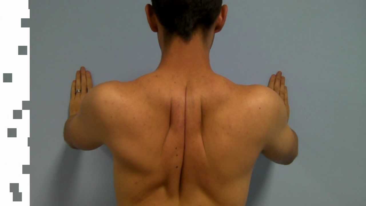 Back Pain Between The Shoulder Blades PainChiropractor YouTube