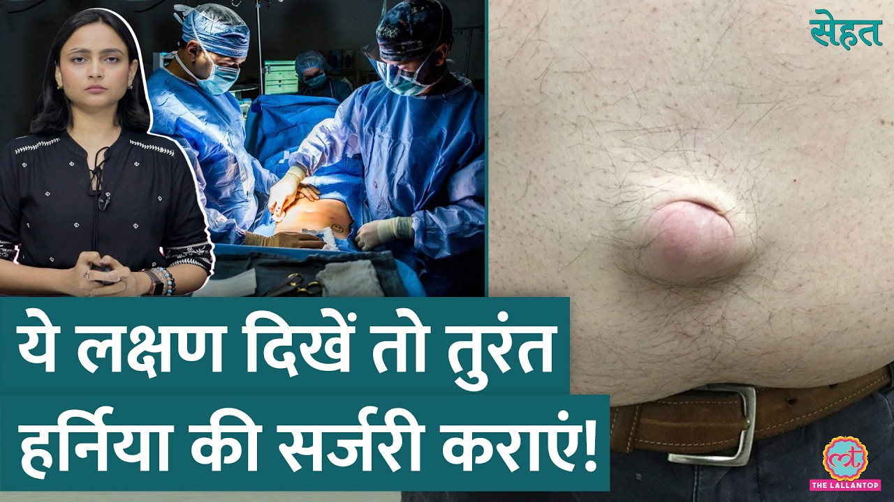 Hernia क्या होता है और Hernia Surgery की ज़रूरत कब है? डॉक्टर से जानिए | Sehat Ep 963