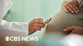 Columbia University confirms first pregnancy using new AI-guided sperm recovery method