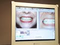 AG Neovo Medical-Grade Dental Display DR-17