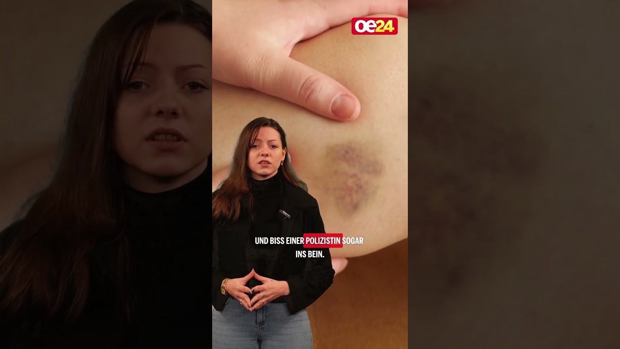 Ungarin beißt Polizisten am Praterstern ins Bein
