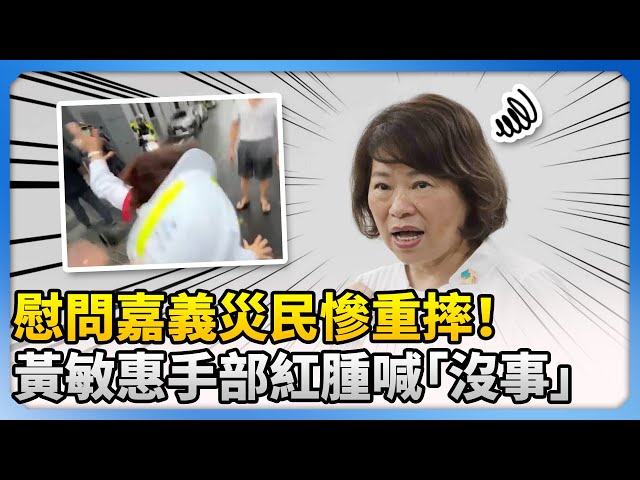 慰問嘉義災民慘重摔！　黃敏惠手部紅腫喊「沒事」 @ChinaTimes
