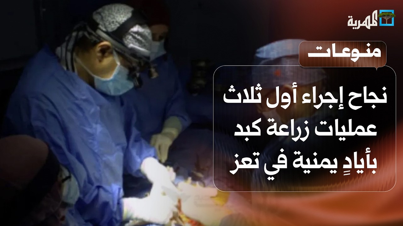 نجاح إجراء أول ثلاث عمليات زراعة كبد بأيادٍ يمنية في مدينة تعز
