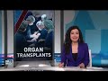 How America’s organ transplant system can be improved  - 06:56 min - News - Video