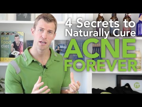 4 Secrets to Get Rid of Acne Naturally