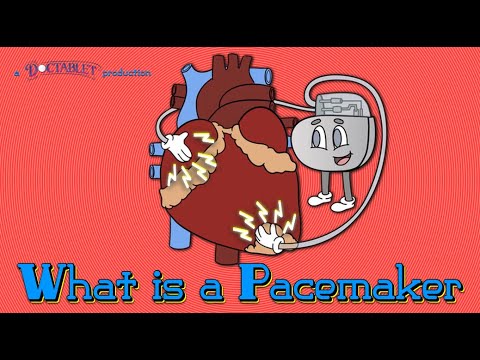 Upload mp3 to YouTube and audio cutter for What is a Pacemaker? Lead-less pacemakers, Cardiac Resynchronization download from Youtube