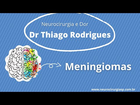 Meningiomas - Saiba tudo sobre os tumores cerebrais primários mais frequentes
