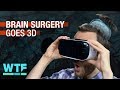 Brain surgery goes 3D- Exclusive