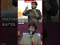 Producer #nagavamsi before & after #indiaglitztelugu #tollywood #ytshorts