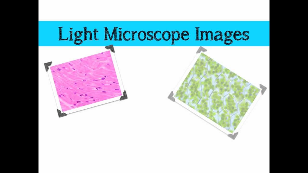 disadvantages-of-electron-microscope-itsreter