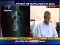NIMS doctors forget scissor in woman's stomach after surgery