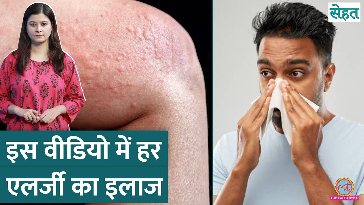 Dust, Pollen, Animal Hair से Allergy क्यों हो जाती है? | Sehat ep 1168