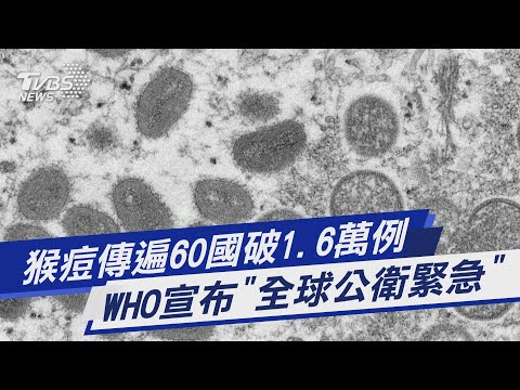 猴痘傳遍60國破1.6萬例 WHO宣布「全球公衛緊急」｜TVBS新聞