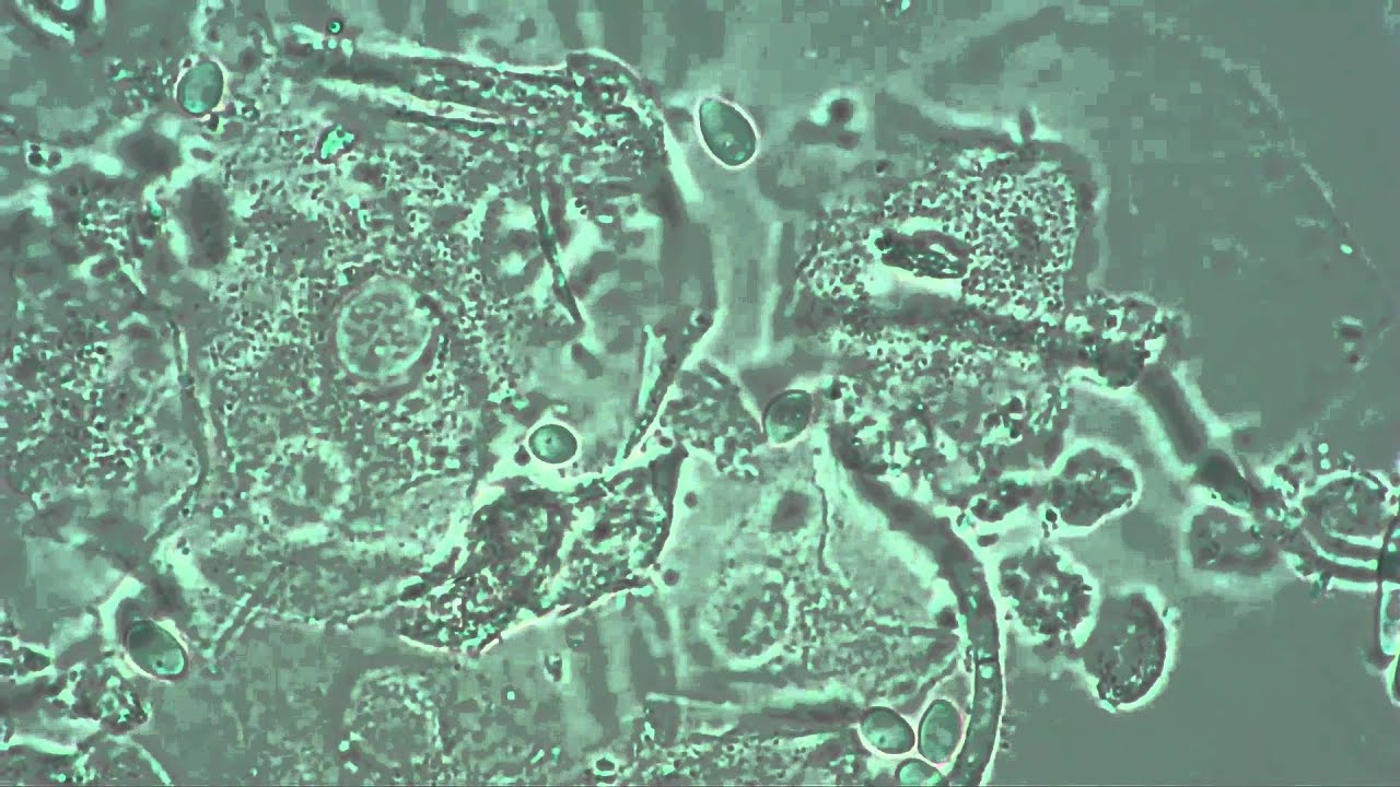 Кандида под микроскопом фото