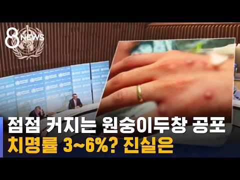 국내도 원숭이두창 공포…'높은 치명률' 3~6% 진실은 / SBS
