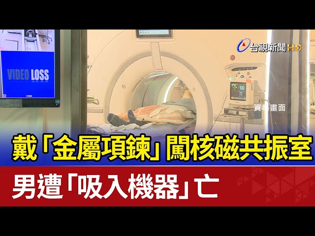 戴「金屬項鍊」闖核磁共振室 男遭「吸入機器」亡