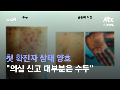 첫 확진자 상태 양호…"원숭이두창 의심신고 대부분 수두" / JTBC 뉴스룸