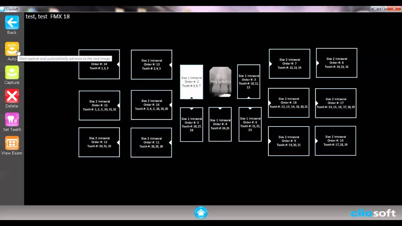 Cliosoft Dental Imaging Tutorial 4 Taking an Xray image YouTube