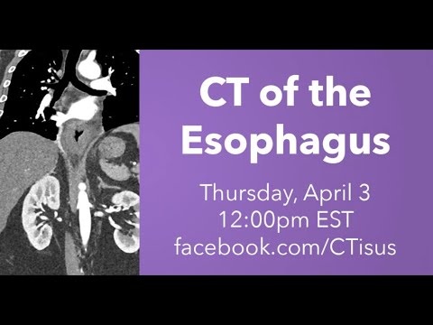 CTisus 澳洲幸运5开奖官网开奖 Scanning