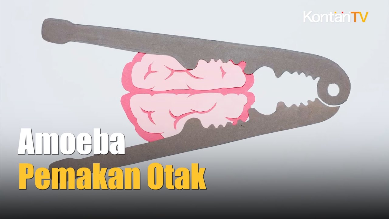 Amoeba Pemakan Otak, Cek Gejala & Obatnya