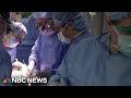 Historic transplant of pigs kidney into human is successful
