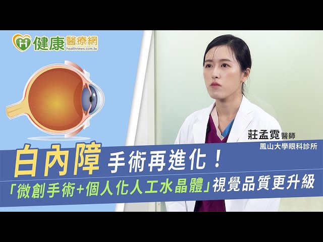 白內障治療微創高安全！ 「微創手術＋個人化人工水晶體」視覺品質更升級