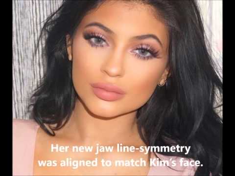 Kylie Jenner's Plastic Surgery Transformation