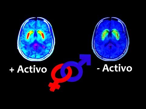 El cerebro femenino es más activo | Noticias 14/8/2017