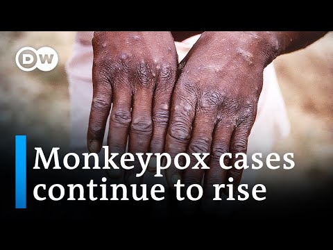 Monkeypox: Health officials assess response as cases spread | DW News