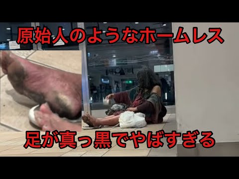 原始人のような女性ホームレス佐藤さんの足を見たら真っ黒すぎてやばすぎる状態だった。