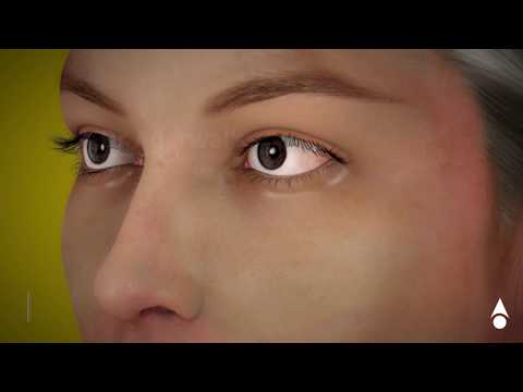 Upload mp3 to YouTube and audio cutter for Cataract animation for Patient Education download from Youtube