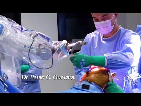 ARTOPLASTIA TOTAL DE RODILLA CON BRAZO ROBÓTICO