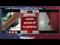 Nurse Speaks After Her Acid Attack On Doctor In Tirupati Court