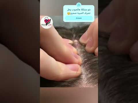 إعداد الصيدلانية: نغم حسين#plasma_cell#Med_life