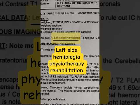 Left side hemiplegia rehabilitation: Arogya physiotips #strokerecovery #stroke