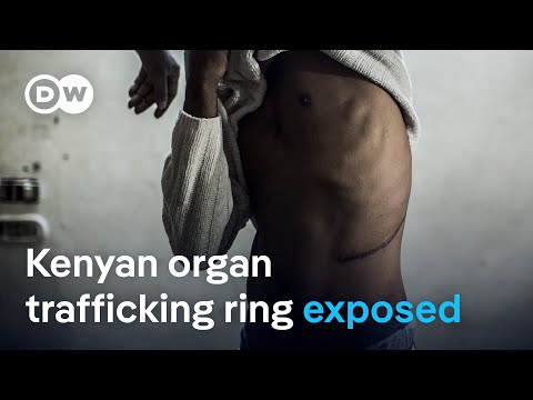 Kenya halts kidney transplants  after DW investigation | DW News