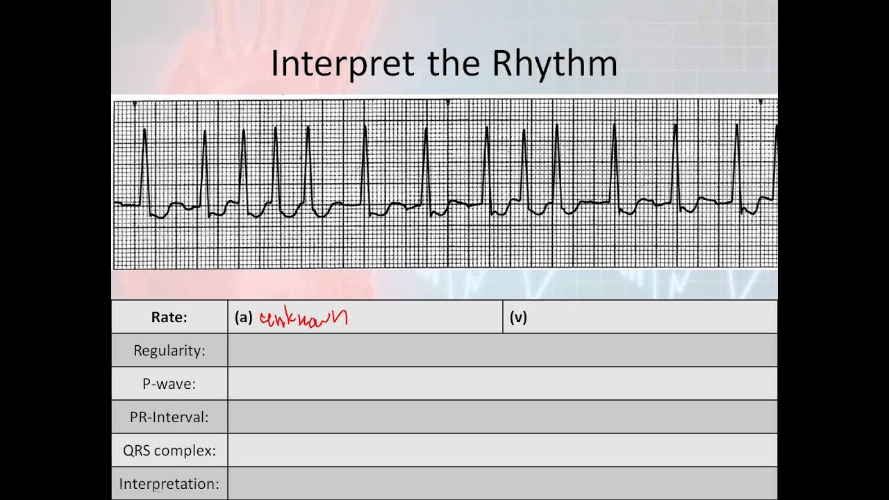 going-with-the-flow-rhythm-art-principles-of-art-art-movement