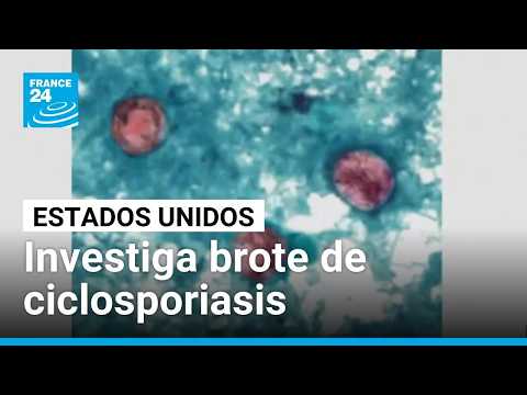 Estados Unidos investiga un brote de ciclosporiasis vinculado a una lechuga mexicana • FRANCE 24
