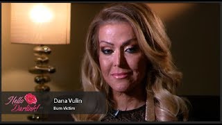 LJUBOMORNA ŽENA JE ŽIVU SPALILA:Nosila masku 3 godine, imala 200 operacija a evo kako danas izgleda – Ex-Yu Portal