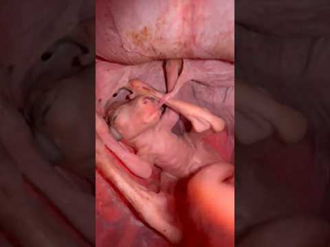 No abras esto El olor es INSOPORTABLE