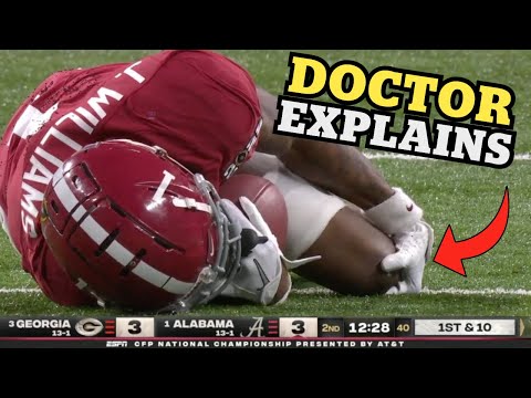 You Could See the ACL Pop - Doctor Explains Jameson Williams Knee Injury