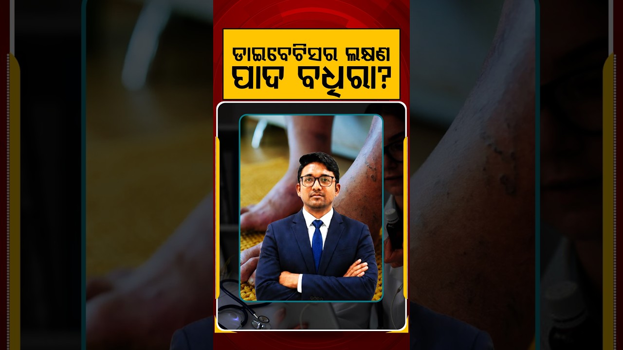 ଡାଇବେଟିସର ଲକ୍ଷଣ ପାଦ ବଧିରା ? | Prescription | Argus Reels | DiabetesSymptoms | DiabetesCare