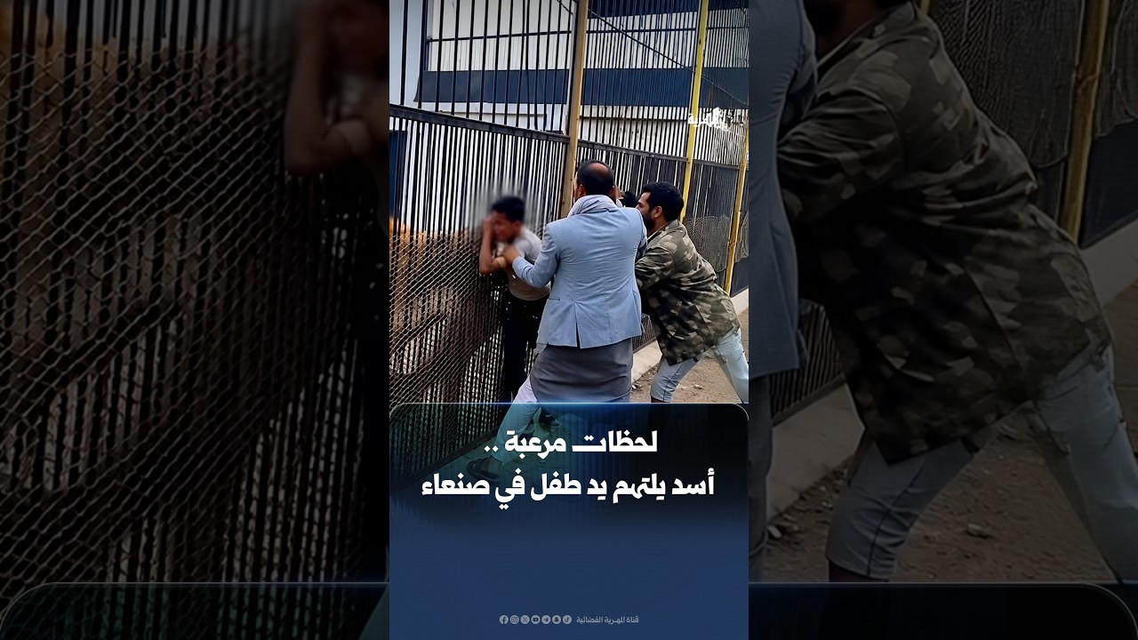 لحظات مرعبة أسد يلتهم يد طفل في صنعاء