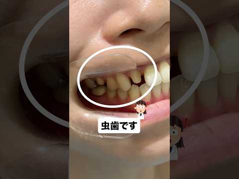 歯医者が嫌いだけど歯にコンプレックスある女性が…