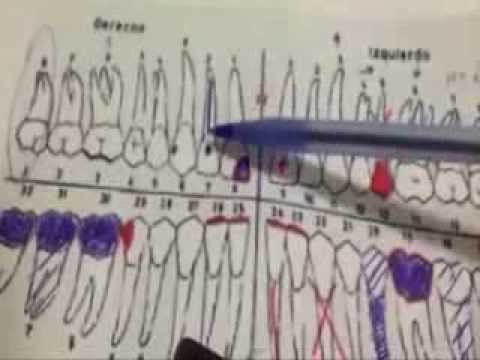 Como Llenar Un Odontograma O Dentigrama YouTube