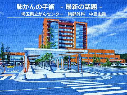 ①第50回がんの集い 肺がんの手術 最新の話題